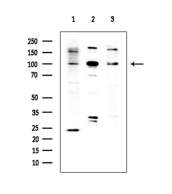 ABCF1 Antibody in Western Blot (WB)