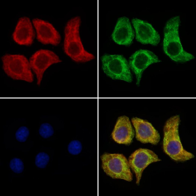 PTPN22 Antibody in Immunocytochemistry (ICC/IF)