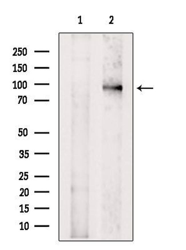 PTPN22 Antibody in Western Blot (WB)