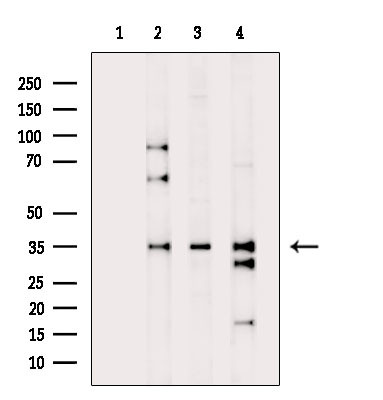 C1orf35 Antibody in Western Blot (WB)