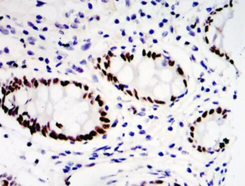 ETV4 Antibody in Immunohistochemistry (Paraffin) (IHC (P))