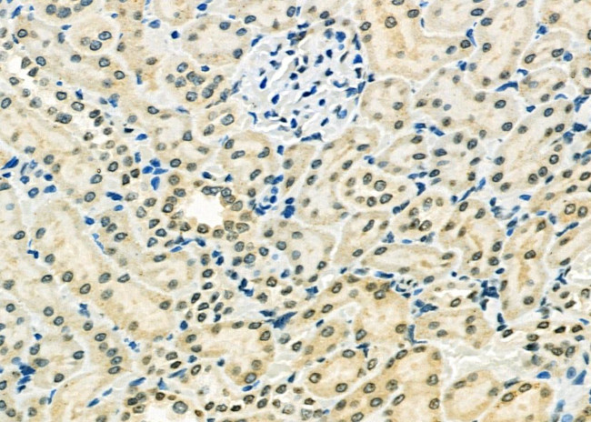 ETV4 Antibody in Immunohistochemistry (Paraffin) (IHC (P))