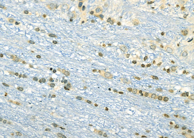 ETV4 Antibody in Immunohistochemistry (Paraffin) (IHC (P))