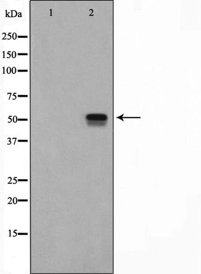 ETV4 Antibody in Western Blot (WB)