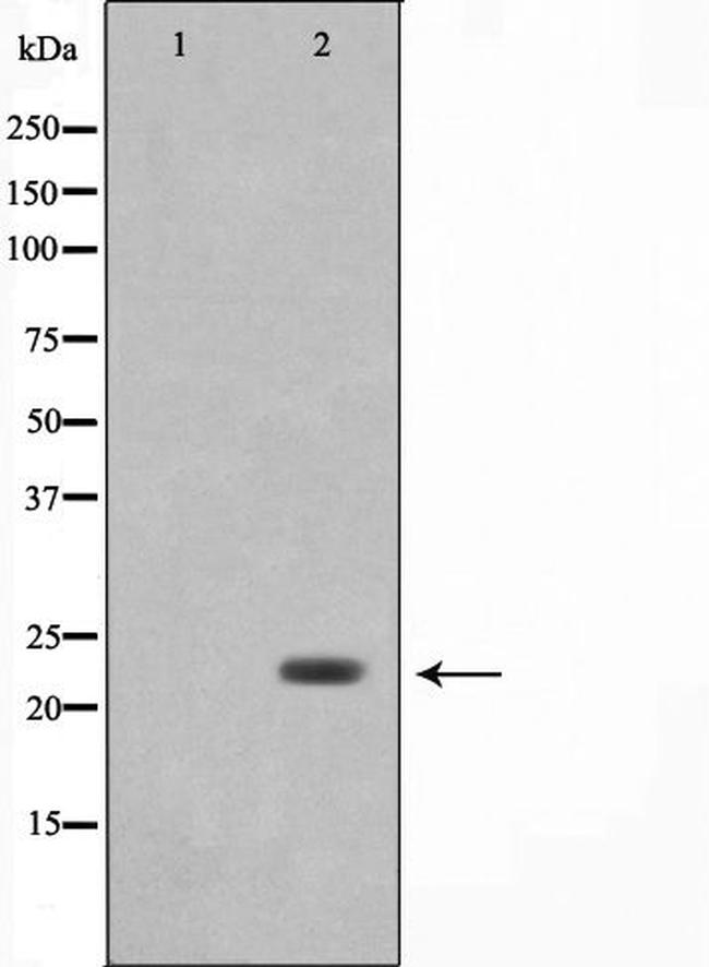 LDOC1L Antibody in Western Blot (WB)