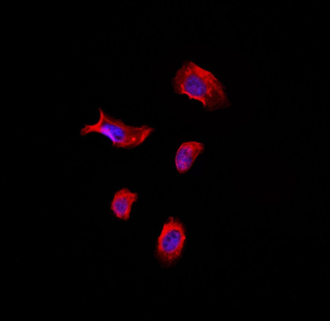 TACC1 Antibody in Immunocytochemistry (ICC/IF)