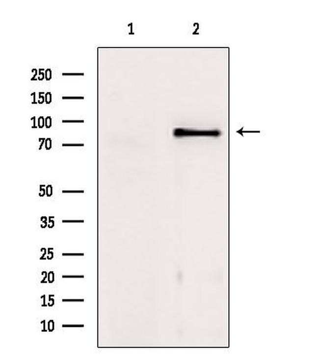 TACC1 Antibody in Western Blot (WB)