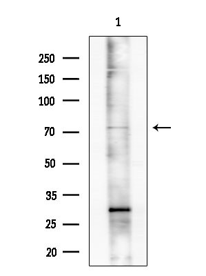 hnRNP M1-M4 Antibody in Western Blot (WB)