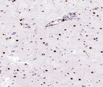 hnRNP M1-M4 Antibody in Immunohistochemistry (Paraffin) (IHC (P))