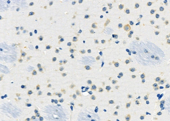 AGPAT9 Antibody in Immunohistochemistry (Paraffin) (IHC (P))