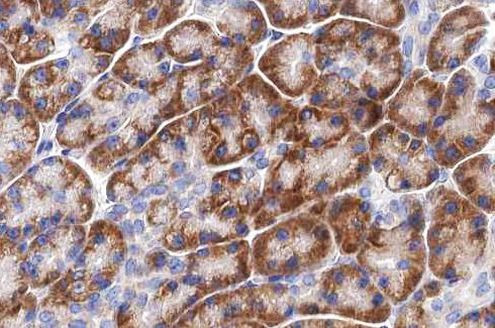 LRAT Antibody in Immunohistochemistry (Paraffin) (IHC (P))