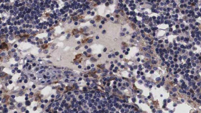 NT5C3A Antibody in Immunohistochemistry (Paraffin) (IHC (P))