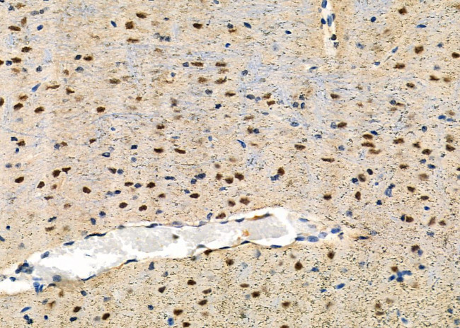 MAST3 Antibody in Immunohistochemistry (Paraffin) (IHC (P))