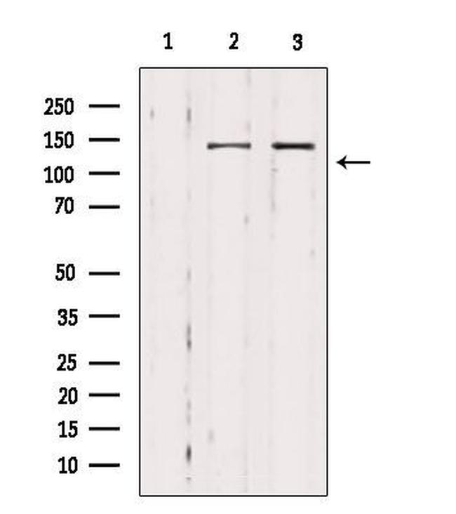 MAST3 Antibody in Western Blot (WB)