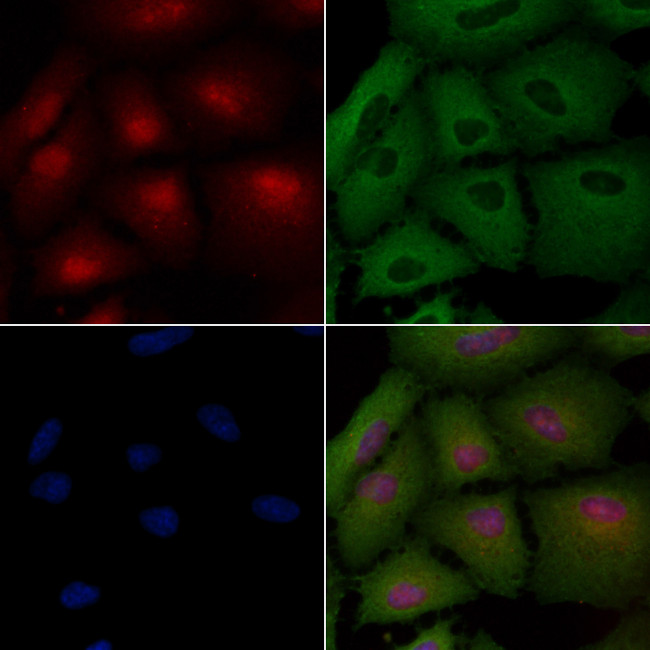 Lass4 Antibody in Immunocytochemistry (ICC/IF)