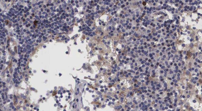 Lass4 Antibody in Immunohistochemistry (Paraffin) (IHC (P))