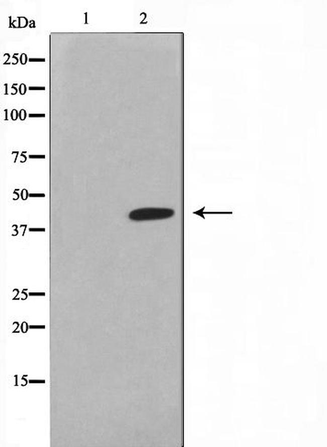 Lass4 Antibody in Western Blot (WB)