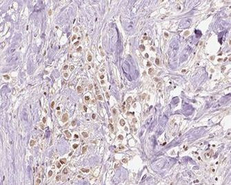 VPS72 Antibody in Immunohistochemistry (Paraffin) (IHC (P))