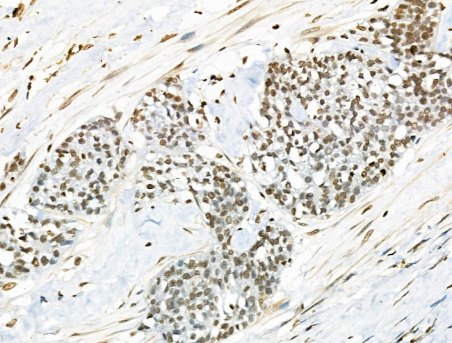 VPS72 Antibody in Immunohistochemistry (Paraffin) (IHC (P))