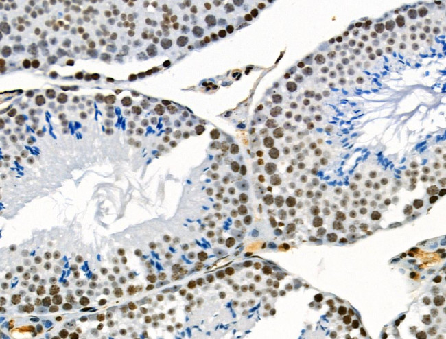 VPS72 Antibody in Immunohistochemistry (Paraffin) (IHC (P))