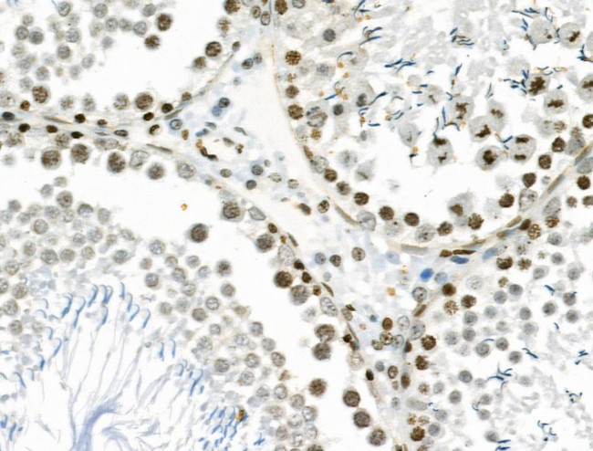 VPS72 Antibody in Immunohistochemistry (Paraffin) (IHC (P))