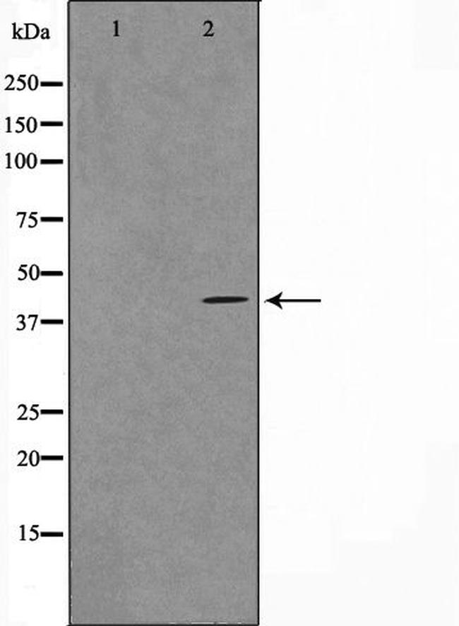 VPS72 Antibody in Western Blot (WB)