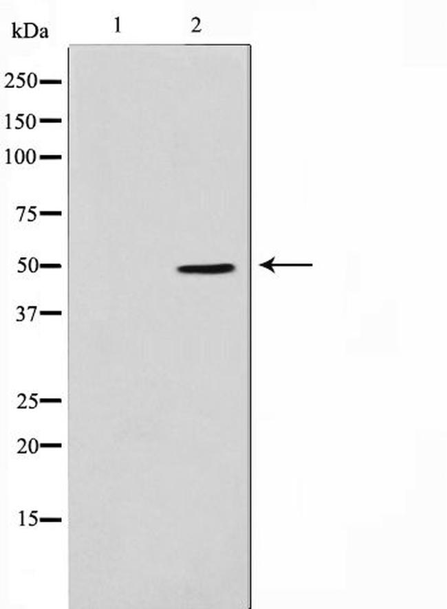 ADPGK Antibody in Western Blot (WB)