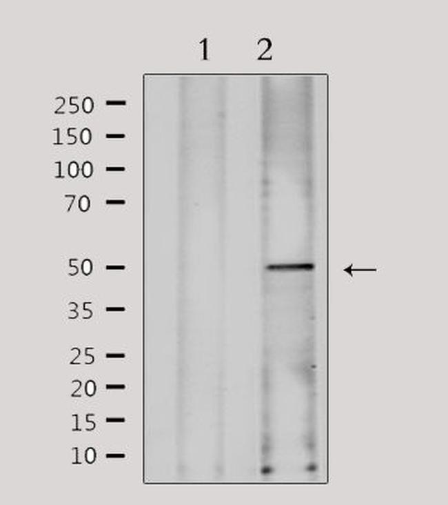 FKRP Antibody in Western Blot (WB)