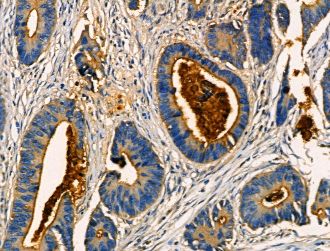 AKAP3 Antibody in Immunohistochemistry (Paraffin) (IHC (P))