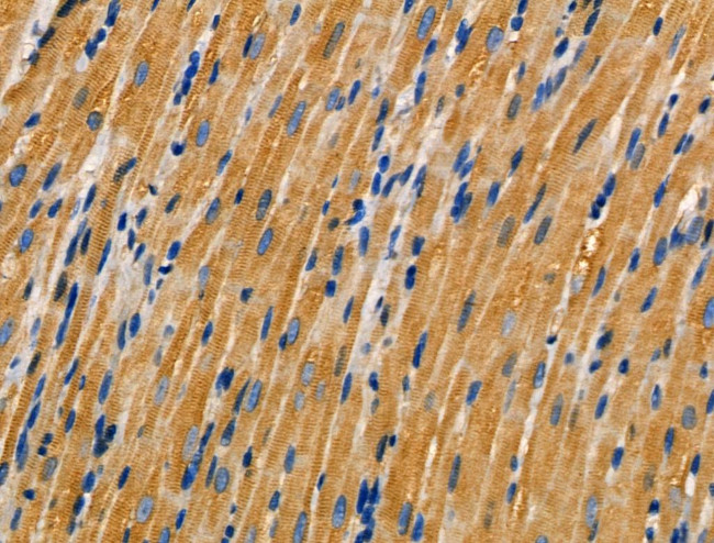 AKAP3 Antibody in Immunohistochemistry (Paraffin) (IHC (P))