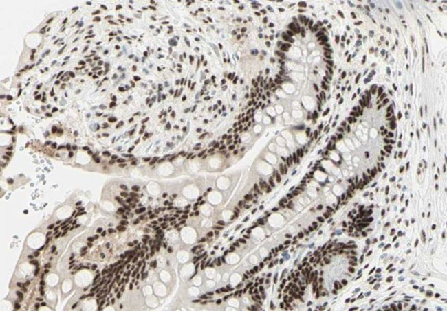 DNA-PK Antibody in Immunohistochemistry (Paraffin) (IHC (P))