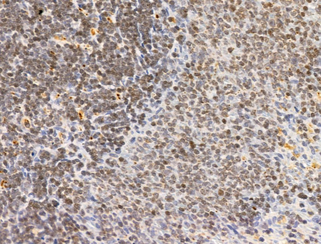 PIAS1 Antibody in Immunohistochemistry (Paraffin) (IHC (P))