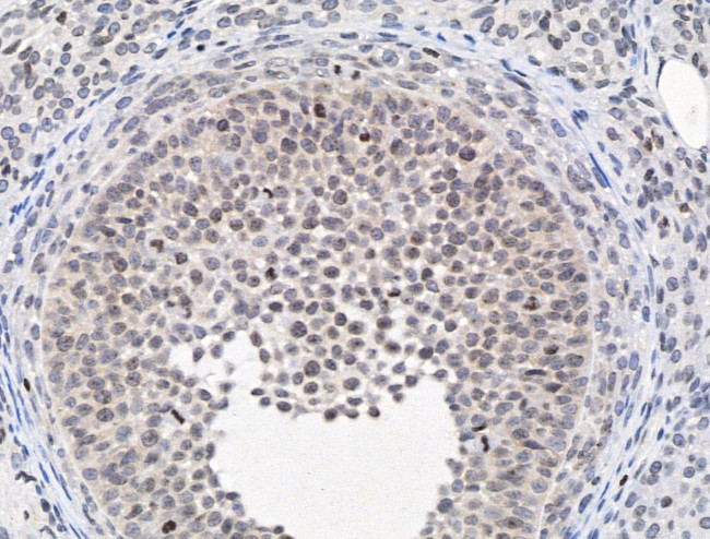 PIAS1 Antibody in Immunohistochemistry (Paraffin) (IHC (P))