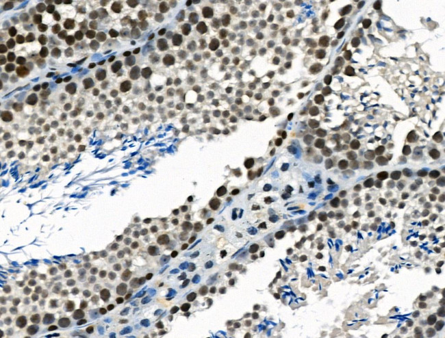 TRIP13 Antibody in Immunohistochemistry (Paraffin) (IHC (P))