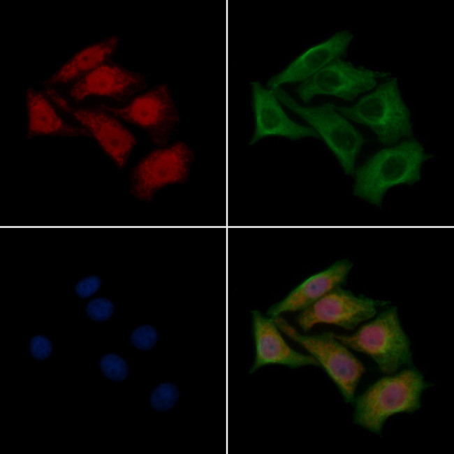 DMPK Antibody in Immunocytochemistry (ICC/IF)