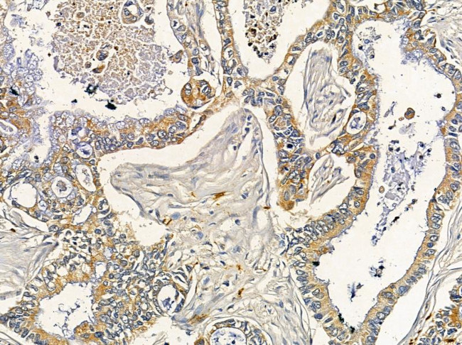 DMPK Antibody in Immunohistochemistry (Paraffin) (IHC (P))