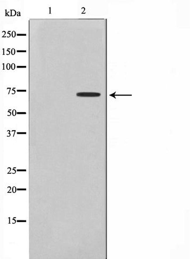 DMPK Antibody in Western Blot (WB)