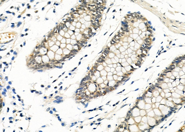 EGR1 Antibody in Immunohistochemistry (Paraffin) (IHC (P))