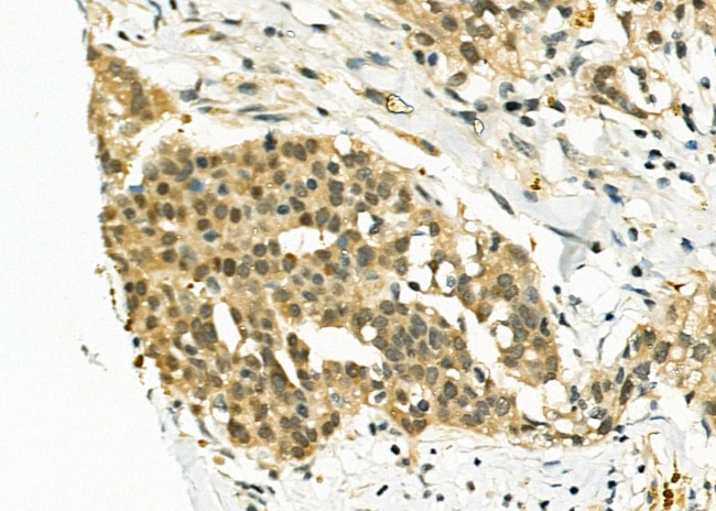 EGR1 Antibody in Immunohistochemistry (Paraffin) (IHC (P))