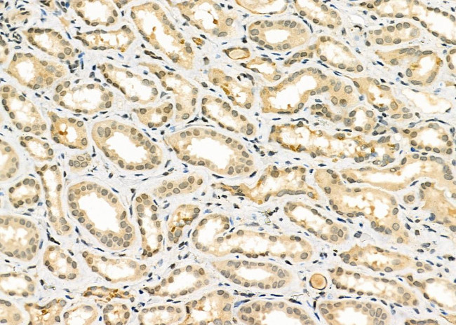 EGR1 Antibody in Immunohistochemistry (Paraffin) (IHC (P))