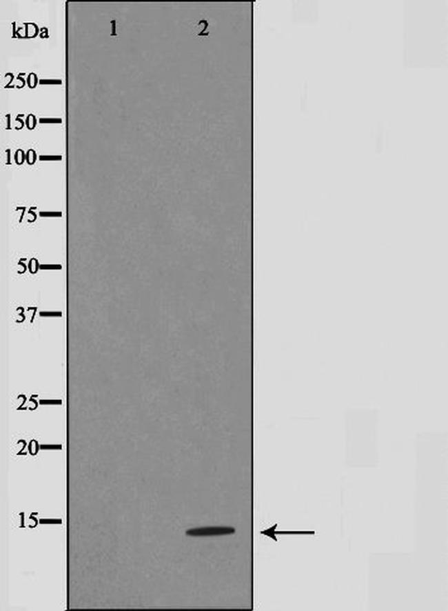 Gastrin Antibody in Western Blot (WB)