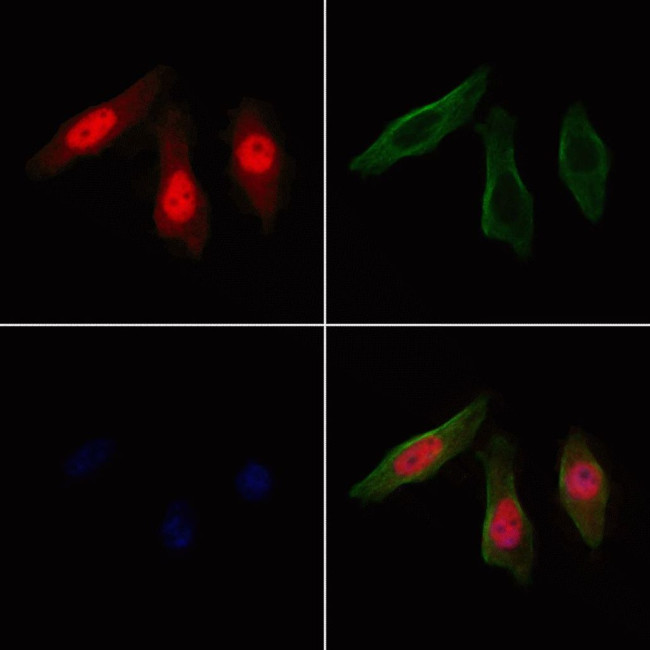 SPDL1 Antibody in Immunocytochemistry (ICC/IF)