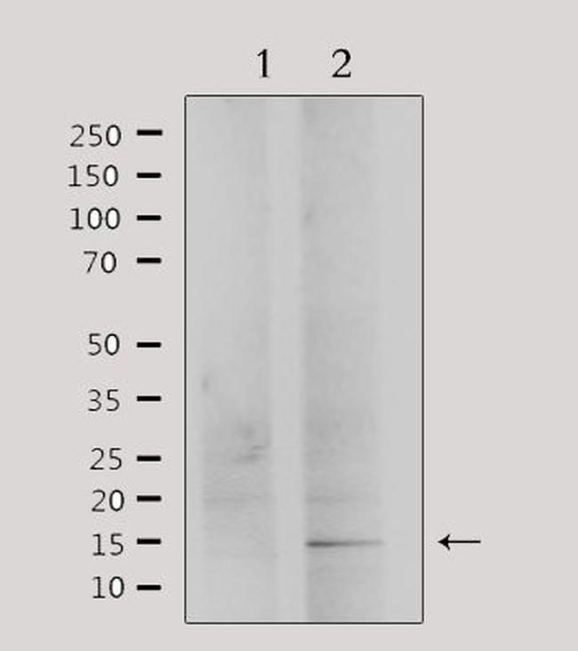 PHLDA2 Antibody in Western Blot (WB)