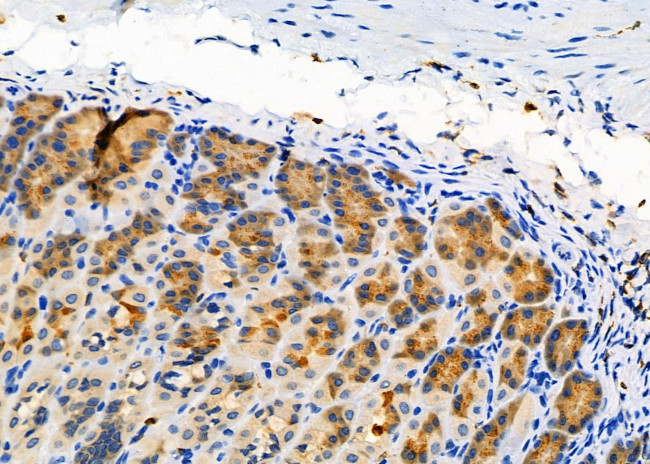 ELOVL1 Antibody in Immunohistochemistry (Paraffin) (IHC (P))