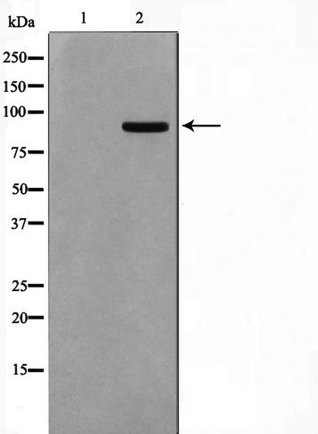 AAK1 Antibody in Western Blot (WB)