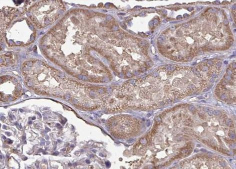 CYP2J2 Antibody in Immunohistochemistry (Paraffin) (IHC (P))