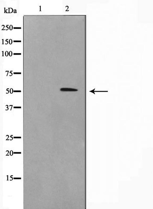 CYP2J2 Antibody in Western Blot (WB)