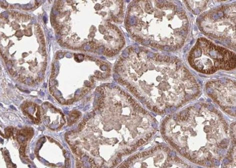 FAP Antibody in Immunohistochemistry (Paraffin) (IHC (P))