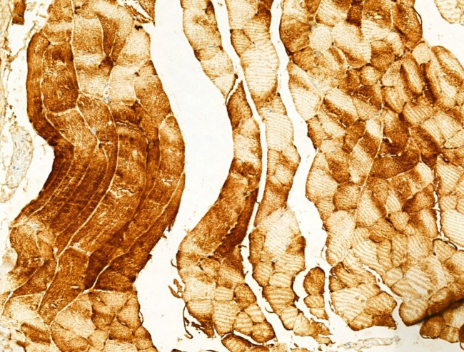 FAP Antibody in Immunohistochemistry (Paraffin) (IHC (P))