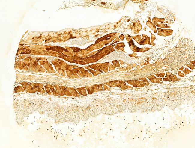 FAP Antibody in Immunohistochemistry (Paraffin) (IHC (P))